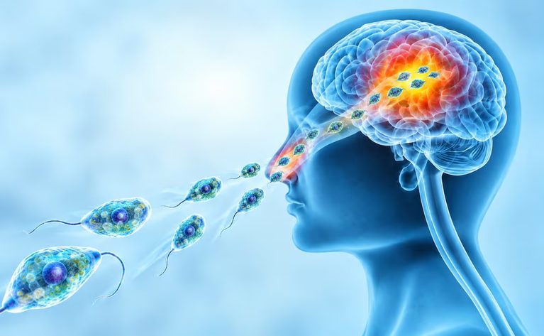 Terror en Catamarca: murió un niño por una ameba que devora el cerebro y cerraron un famoso complejo termal